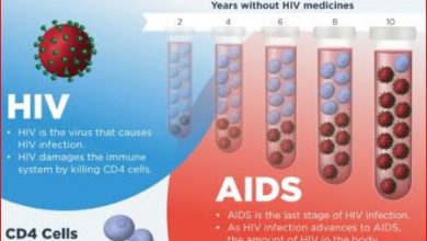 define hiv and aids