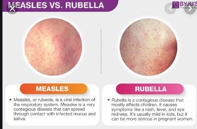 Difference Between Measles And Rubella
