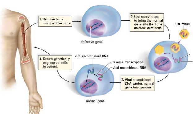 Use of viruses in gene therapy